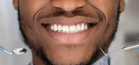 dental bonding
