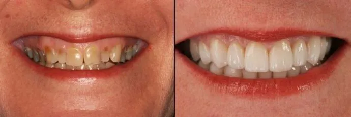 before after photo