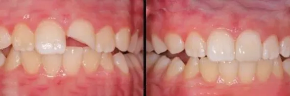 before-after-dental-work