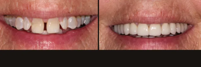 before-after-dentist