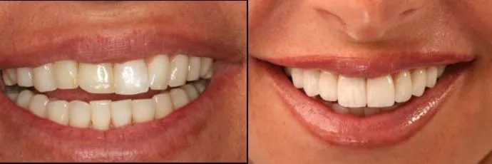 dental before after