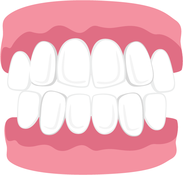 Open Bite