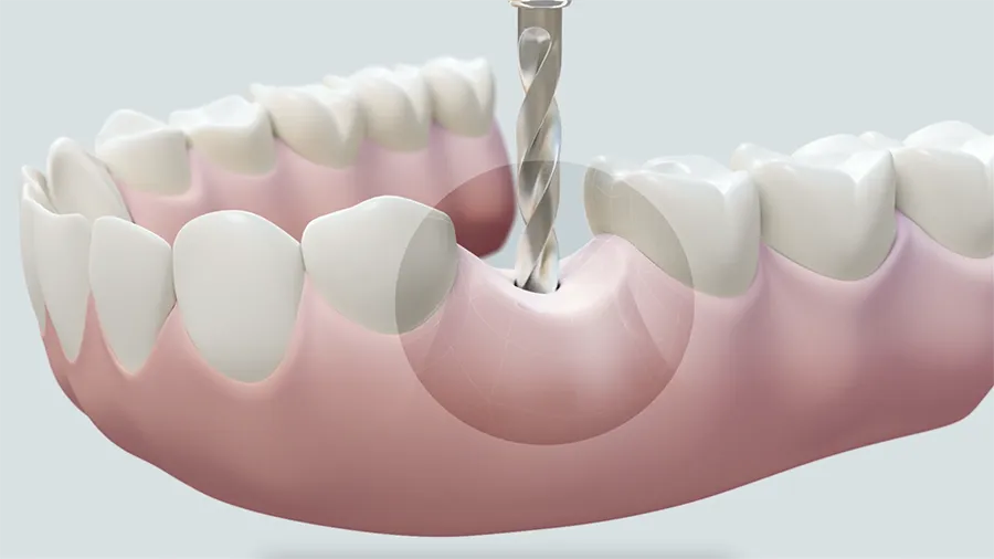 Dental Video